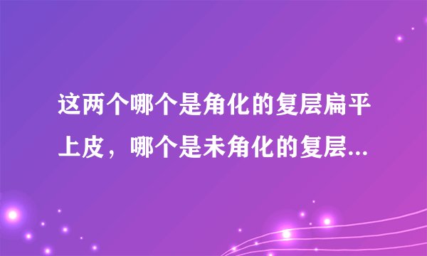 这两个哪个是角化的复层扁平上皮，哪个是未角化的复层扁平上皮，怎样区别