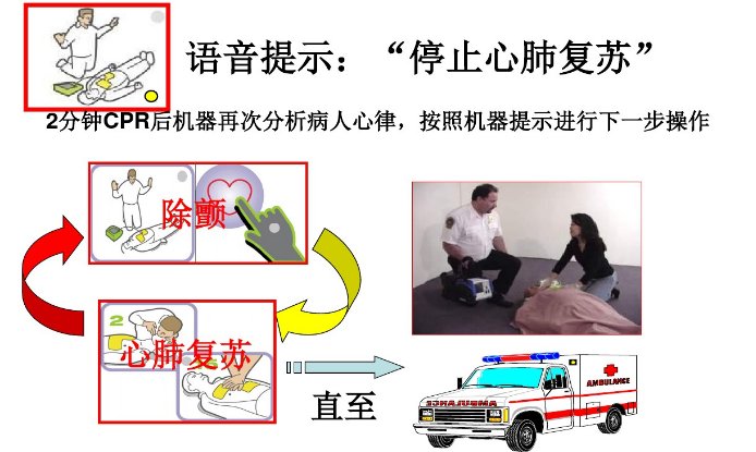 除颤的操作过程