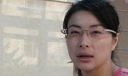 为什么37岁郭晶晶满头白发？