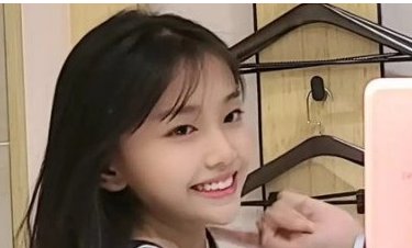 宋小睿真的整容了吗？