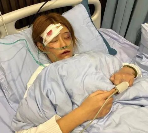 百万网红王多鱼遭男友家暴住院，满身伤痕为何却被质疑演戏？