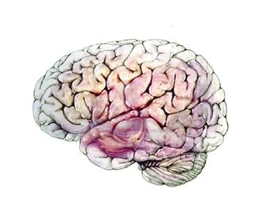 脑交什么意思了？？？？？？