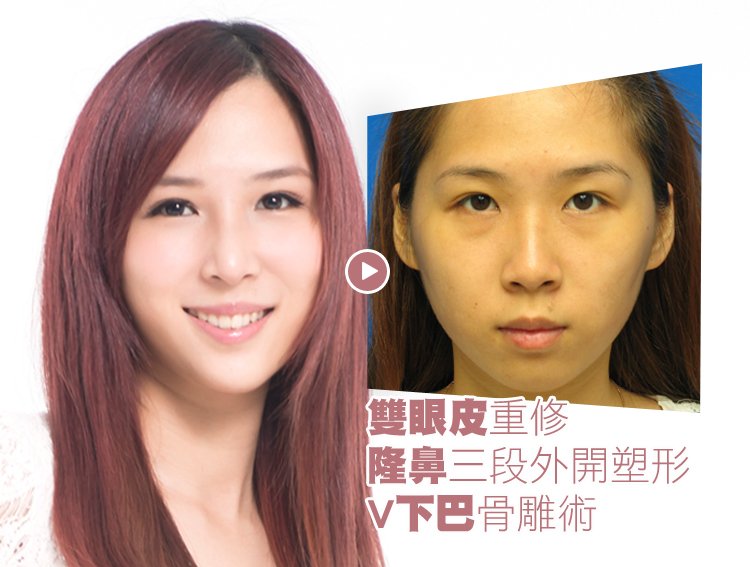 名医进化的目录