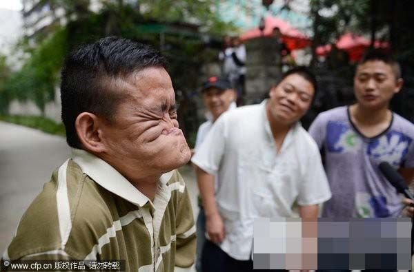 烂脸王的吉尼斯获奖