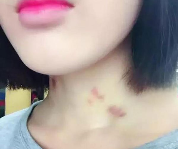 什么性格的男生会种草莓 太害羞了怎么出去见人