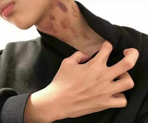 什么性格的男生会种草莓 太害羞了怎么出去见人