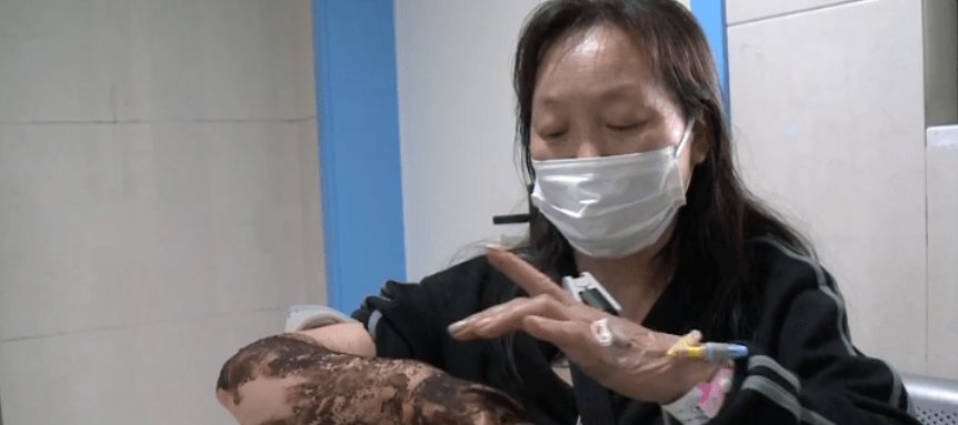 重庆女子江边散步被毒蛇咬伤，几分钟后便意识模糊，身体出现了哪些症状？