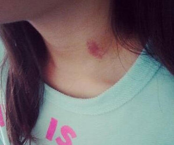 什么性格的男生会种草莓 太害羞了怎么出去见人