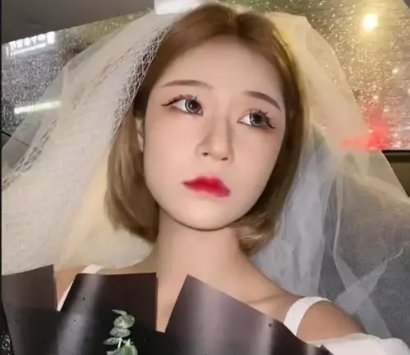 百万网红王多鱼遭男友家暴住院，满身伤痕为何却被质疑演戏？