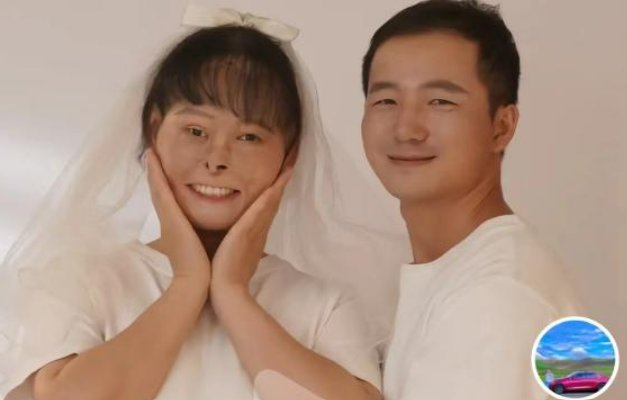 面部烧伤女孩孕妇照引关注！其丈夫为何能对其不离不弃？