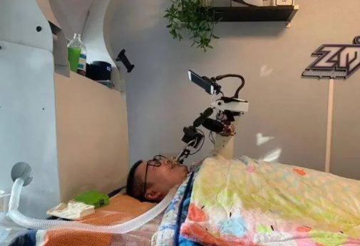 “嘴强王者”朱铭骏多器官衰竭，已抢救多次，他究竟患上了什么疾病？