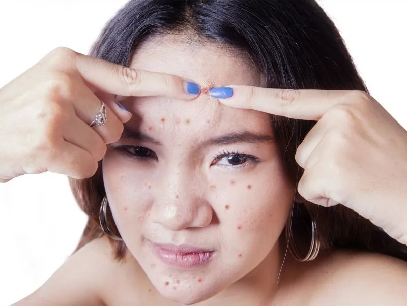 脸颊长痘痘是怎么回事