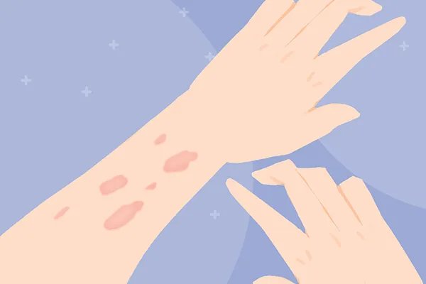 苦楝皮的功效与作用