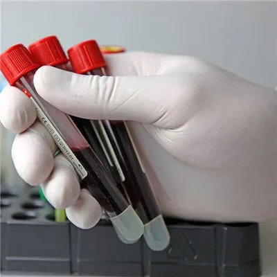 什么是淋巴管炎？