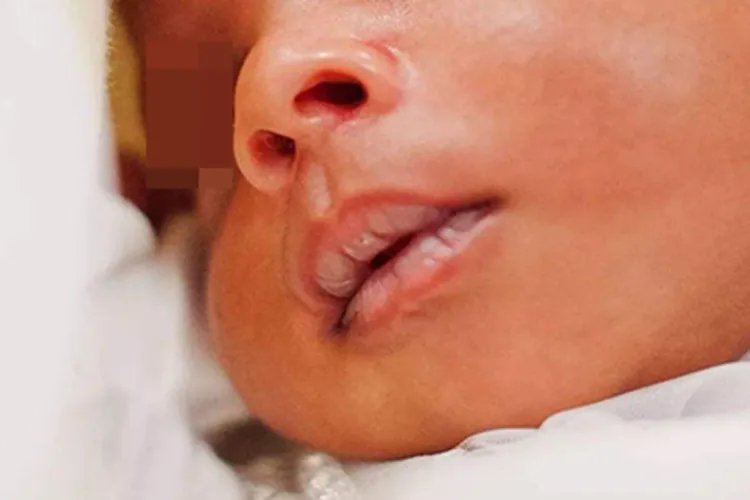 宝宝嘴唇发白2个月图片