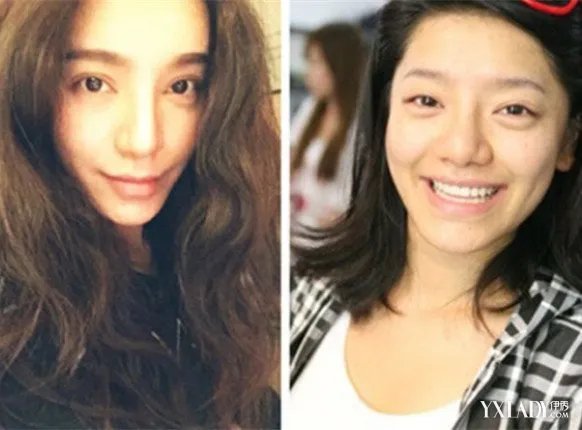 江映蓉整容前后照片对比要出名就得先整容