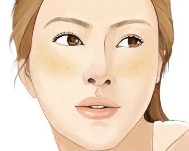 祛斑大概多少钱