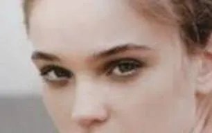 假体隆鼻整容要多少钱