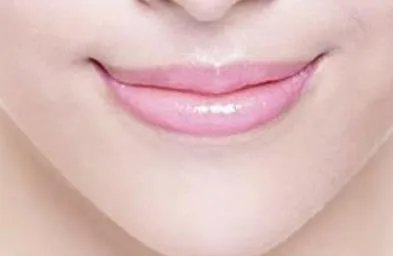 玻尿酸丰唇手术多少钱