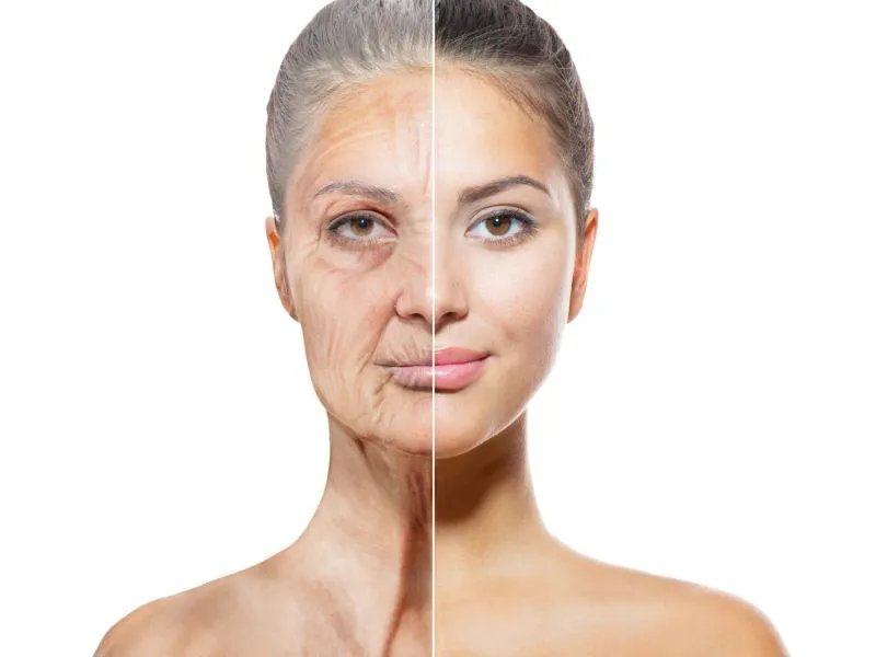 额头长皱纹怎么办