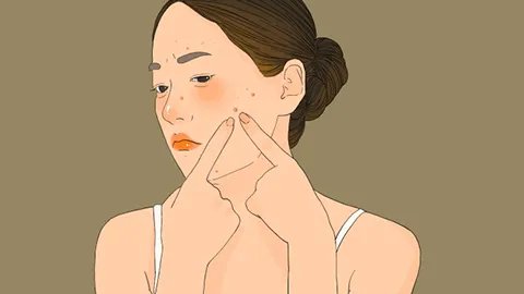 脸上的痘印怎么能去除