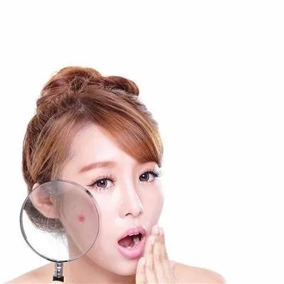 脸颊长斑怎么办