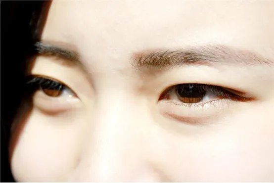 眼袋是怎么形成的