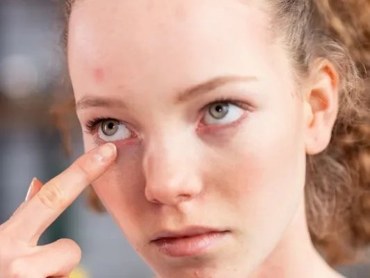 红眼病怎么治疗