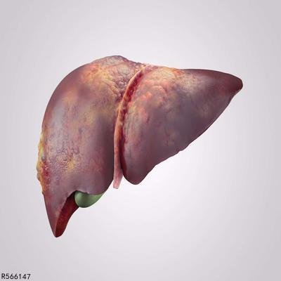 肝包虫病是怎么得的