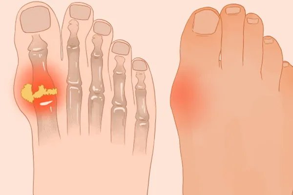 羌活的作用与功效