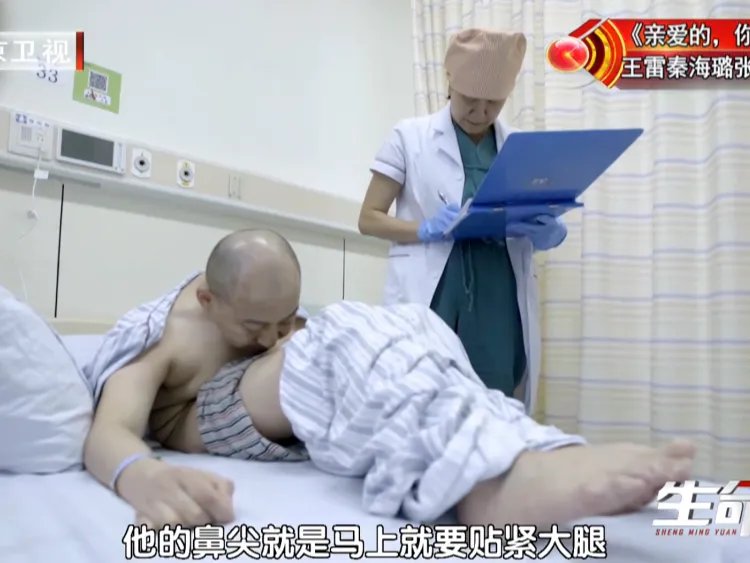 打开折叠人生——极重度脊柱后凸3-ON折叠人手术