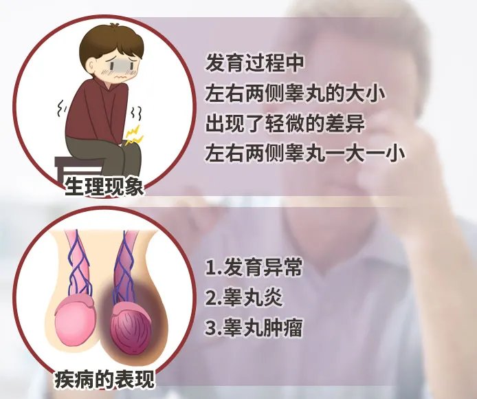 睾丸一个大一个小是什么原因