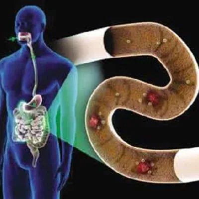 孕妇痔疮是怎么回事啊?