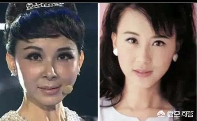 有哪些整容失败的明星？