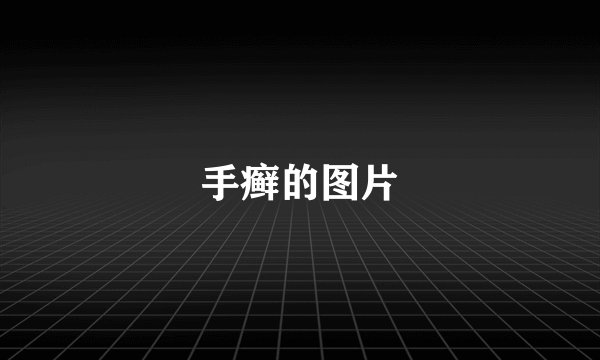 手癣的图片