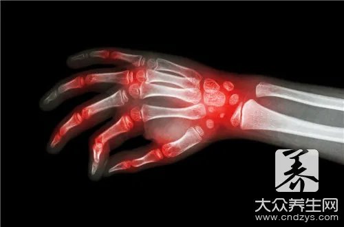 经络不通是什么症状?