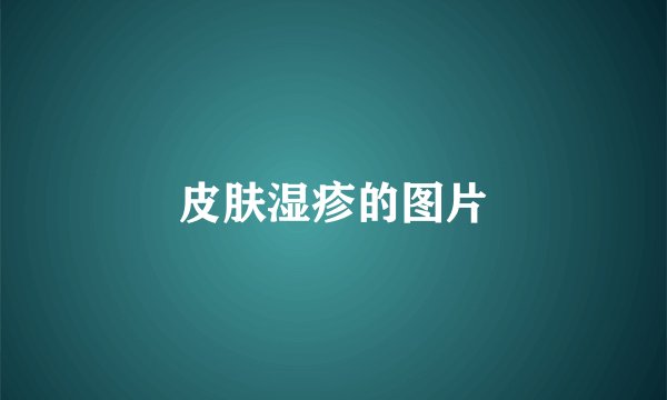 皮肤湿疹的图片