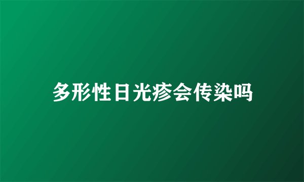 多形性日光疹会传染吗