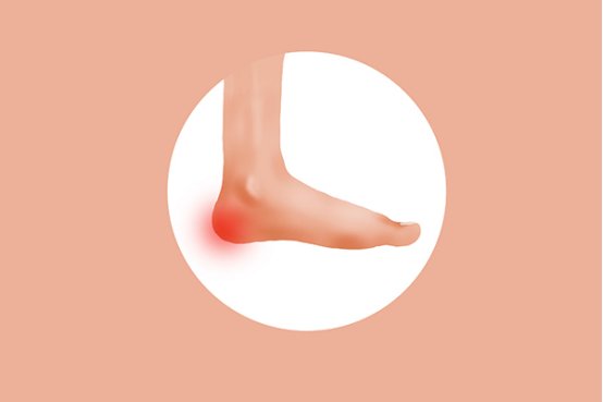 脚后跟干裂起硬皮是什么原因