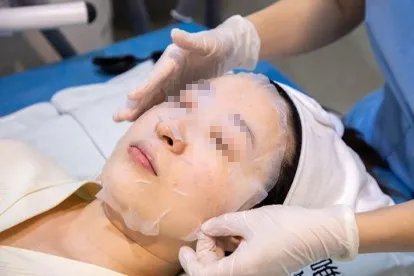 光子嫩肤过程图片