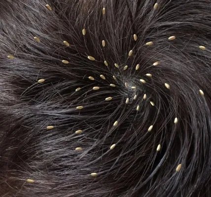 头虱喷上虱立净多久会死