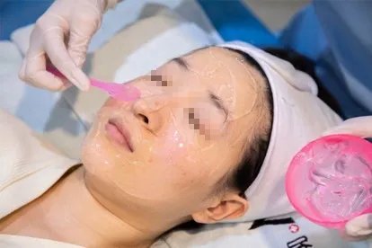 光子嫩肤过程图片