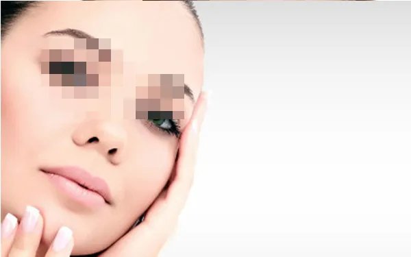 射频除皱大概多少钱