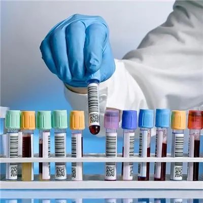 大便后出血是怎么回事