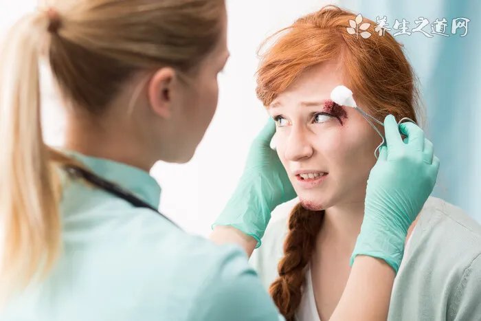 眼球出血是怎么回事