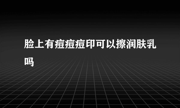 脸上有痘痘痘印可以擦润肤乳吗