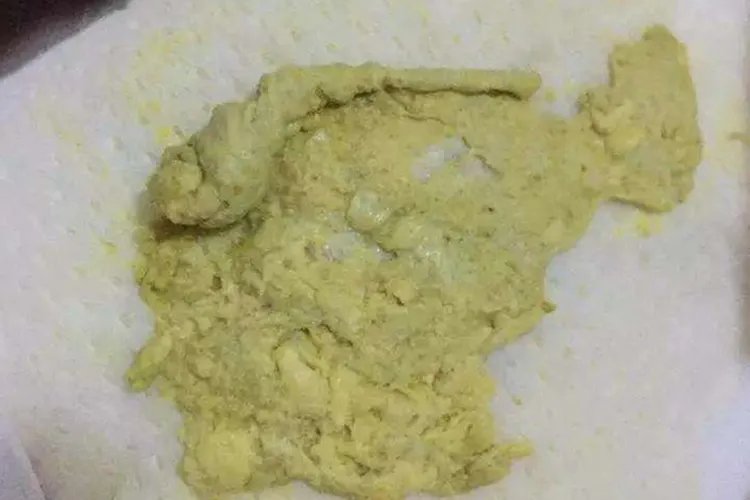 大便颜色9种图解