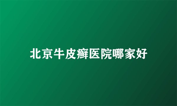 北京牛皮癣医院哪家好