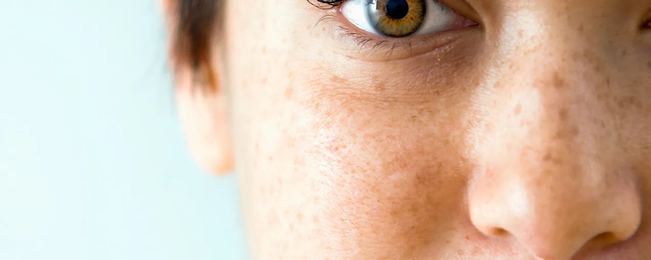 白醋洗脸美白祛斑的方法