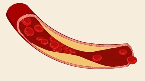 深海鱼油的作用